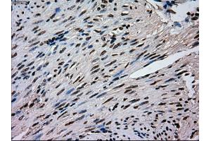 Immunohistochemistry (IHC) image for anti-Mitogen-Activated Protein Kinase 1 (MAPK1) antibody (ABIN1499293)