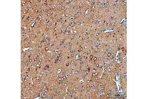 IHC analysis of SEC22B using anti-SEC22B antibody (ABIN7602121).