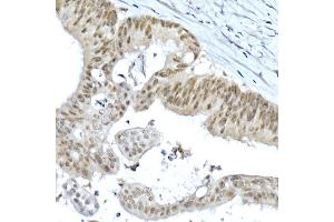 Immunohistochemistry of paraffin-embedded rat ovary using LGR5/GPR49 Rabbit pAb  at dilution of 1:300 (40x lens).