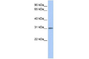 WB Suggested Anti-ODF3L1 Antibody Titration: 0. (ODF3L1 anticorps  (N-Term))