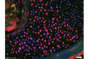 Formalin-fixed and paraffin-embedded rat brain labeled with Anti-Phospho-MEF2A (Ser408) Polyclonal Antibody, Unconjugated (ABIN743783) 1:200, overnight at 4°C, The secondary antibody was Goat Anti-Rabbit IgG, Cy3 conjugated used at 1:200 dilution for 40 minutes at 37°C. (MEF2A anticorps  (pSer408))