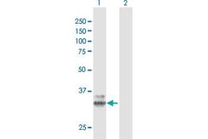 Western Blot analysis of PPT1 expression in transfected 293T cell line by PPT1 MaxPab polyclonal antibody. (PPT1 anticorps  (AA 1-306))