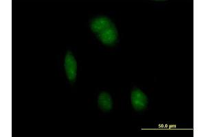 Immunofluorescence of purified MaxPab antibody to FTSJ1 on HeLa cell. (FTSJ1 anticorps  (AA 1-329))