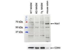 AP31401PU-N NOX1 antibody staining of MASM lysate at 1 µg/ml (35 µg protein in RIPA buffer). (NOX1 anticorps  (Internal Region))