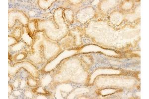 ABIN6265674 and ABIN6266664 at 1/100 staining human normal kidney tissue by IHC-P.