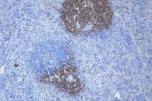 IHC analysis of CD3 epsilon/Cd3e using anti-CD3 epsilon/Cd3e antibody (ABIN7600665). (CD3 epsilon anticorps  (AA 22-113))