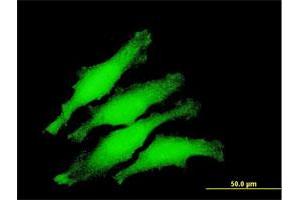 Immunofluorescence of purified MaxPab antibody to ZNF397 on HeLa cell.