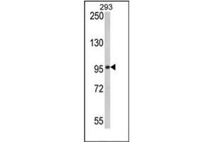 Image no. 1 for anti-DEAD (Asp-Glu-Ala-Asp) Box Polypeptide 58 (DDX58) (AA 592-622) antibody (ABIN357195) (DDX58 anticorps  (AA 592-622))