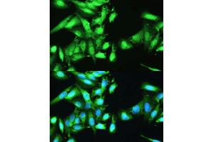 Immunofluorescence analysis of U2OS cells using STAT1 antibody.