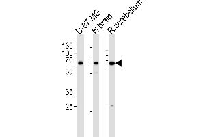 Western blot analysis of lysates from U-87 MG cell line , human brain and rat cerebellum tissue lysate(from left to right), using Mouse Camkk2 Antibody at 1:1000 at each lane.