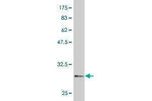 Western Blot detection against Immunogen (31.