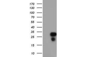 Western Blotting (WB) image for anti-Regulator of G-Protein Signaling 16 (RGS16) antibody (ABIN1500691) (RGS16 anticorps)