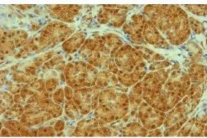 Image no. 3 for anti-Transportin 1 (TNPO1) antibody (ABIN108619)