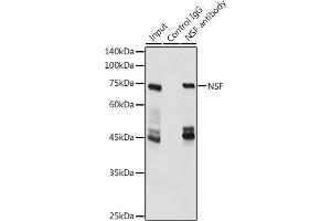 Immunoprecipitation analysis of 600 μg extracts of Mouse brain cells using 3 μg NSF antibody (ABIN6130571, ABIN6144871, ABIN6144872 and ABIN6214029).