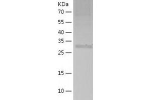 Western Blotting (WB) image for Mitochondrial Ribosomal Protein S2 (MRPS2) (AA 1-296) protein (His-IF2DI Tag) (ABIN7123984)