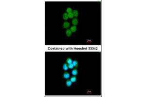 ICC/IF Image Immunofluorescence analysis of methanol-fixed A431, using TDP1, antibody at 1:200 dilution. (TDP1 anticorps)
