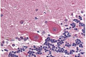 Human Brain, Cerebellum: Formalin-Fixed, Paraffin-Embedded (FFPE)