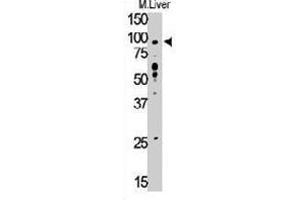 Western blot analysis of TLR6 polyclonal antibody  in mouse liver tissue lysate (35 ug/lane). (TLR6 anticorps  (C-Term))