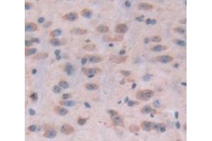 Used in DAB staining on fromalin fixed paraffin- embedded Kidney tissue (POMT1 anticorps  (AA 318-513))