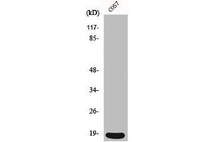 Western Blot analysis of COS7 cells using p18 Polyclonal Antibody (CDKN2C anticorps  (C-Term))