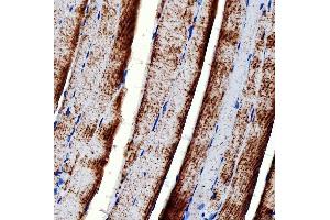 IHC analysis of RAB7/RAB7A using anti-RAB7/RAB7A antibody (ABIN7600597). (RAB7A anticorps  (AA 21-177))