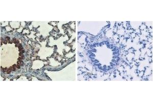 Expression of CFTR in rat lungs - Immunohistochemical staining of rat lungs sections using Anti-CFTR Antibody (ABIN7043096, ABIN7044127 and ABIN7044128) (left panel). (CFTR anticorps  (C-Term, Cytosolic))