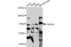 Western blot analysis of extracts of various cell lines, using CNGA4 antibody (ABIN6291314) at 1:1000 dilution. (CNGA4 anticorps)