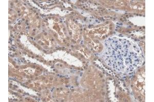 DAB staining on IHC-P; Samples: Human Kidney Tissue (DICER1 anticorps  (AA 6-290))