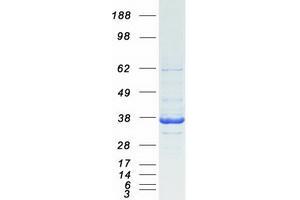 Validation with Western Blot