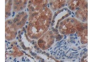Detection of Cys-C in Human Kidney Tissue using Polyclonal Antibody to Cystatin C (Cys-C) (Cystathionine-gamma-Synthase Precursor (CYS) (AA 27-146) anticorps)