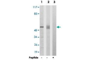 Western blot analysis of extracts from 293 cells (Lane 1) and mouse liver cells (Lane 2 and lane 3), using ACVR1B polyclonal antibody . (Activin A Receptor Type IB/ALK-4 anticorps  (AA 73-122))