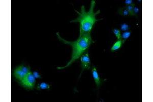 Image no. 4 for anti-Aldehyde Dehydrogenase 1 Family, Member L1 (ALDH1L1) antibody (ABIN1496585) (ALDH1L1 anticorps)