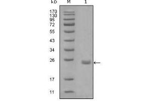 Western Blot showing AXL antibody used against truncated Trx-AXL recombinant protein (1). (AXL anticorps  (AA 466-530))