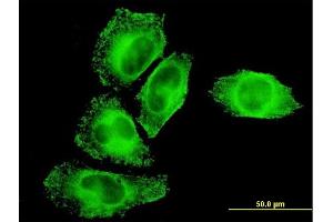 Immunofluorescence of monoclonal antibody to IKBKG on HeLa cell.