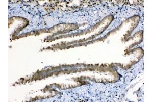 IHC testing of FFEP rat lung tissue with Periplakin antibody at 1ug/ml.