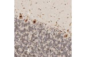 Immunohistochemical staining of human cerebellum with GPBP1L1 polyclonal antibody  shows strong nuclear positivity in purkinje cells.