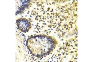 Immunohistochemistry of paraffin-embedded Human colon using MSH2 antibody at dilution of 1:100 (x400 lens).