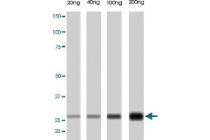 PRSS1 monoclonal antibody, clone A16-N  . (PRSS1 anticorps  (N-Term))