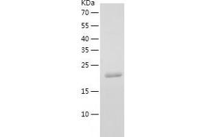 Western Blotting (WB) image for YKT6 V-SNARE Homolog (YKT6) (AA 1-198) protein (His-IF2DI Tag) (ABIN7125758)
