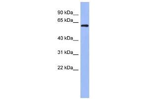 WB Suggested Anti-RBM47 Antibody Titration: 0. (RBM47 anticorps  (Middle Region))