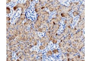 IHC analysis of PCK1/PEPC using anti-PCK1/PEPC antibody (ABIN7599502). (PCK1 anticorps  (AA 1-622))