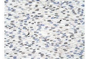 RBM28 antibody was used for immunohistochemistry at a concentration of 4-8 ug/ml to stain Myocardial cells (arrows) in Human Heart. (RBM28 anticorps  (C-Term))