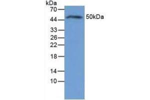Figure. (IL-6 Receptor anticorps  (AA 19-10))