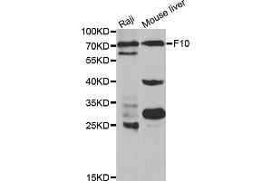 Western blot analysis of extracts of various cell lines, using F10 antibody (ABIN5970678) at 1/1000 dilution. (Coagulation Factor X anticorps)