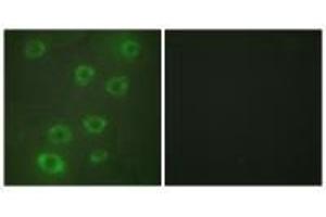 Immunofluorescence analysis of HUVEC cells, using PTX3 antibody.