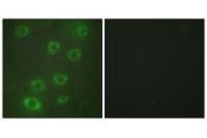 Immunofluorescence analysis of HUVEC cells, using PTX3 antibody. (PTX3 anticorps  (N-Term))