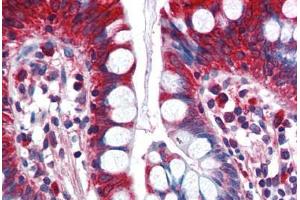 Human Small Intestine (formalin-fixed, paraffin-embedded) stained with ACSL5 antibody ABIN351483 at 2. (ACSL5 anticorps  (AA 727-739))