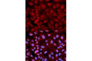 Immunofluorescence analysis of U2OS cells using SNCG antibody (ABIN5971355). (SNCG anticorps)