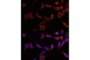 Immunofluorescence analysis of NIH-3T3 cells using PTPN13 Polyclonal Antibody (ABIN6132534, ABIN6146442, ABIN6146443 and ABIN6216830) at dilution of 1:100 (40x lens). (PTPN13 anticorps  (AA 250-500))