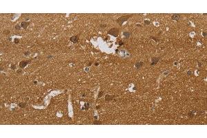 Immunohistochemistry of paraffin-embedded Human brain tissue using ELAVL2 Polyclonal Antibody at dilution 1:40